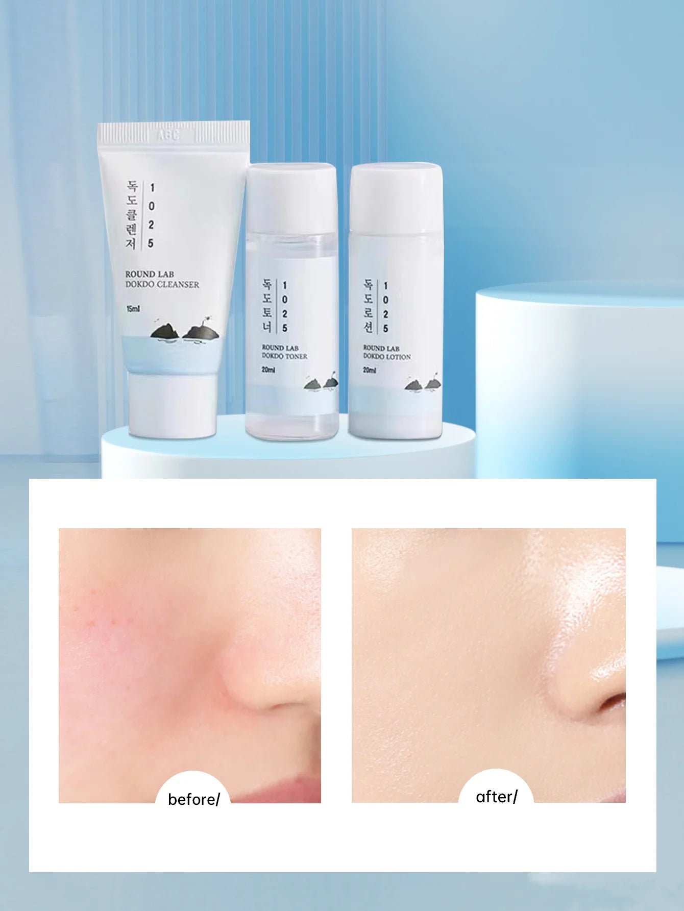 Round Lab 1025 Dokdo Skincare Set – Kit Mini 3 Pasos Piel Acneica