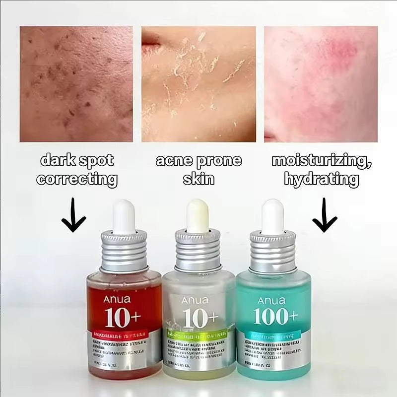 ANUA Niacinamide + Hyaluronic Acid Serum – Sérum Hidratante e Iluminador Esencial