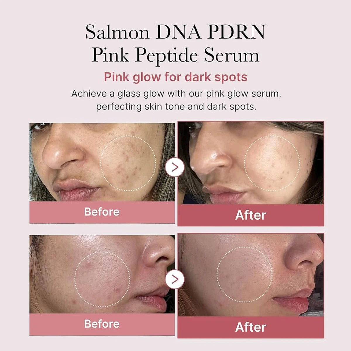 Medicube PDRN Salmon DNA Pink Peptide Serum – Reafirmante y Reparador Facial