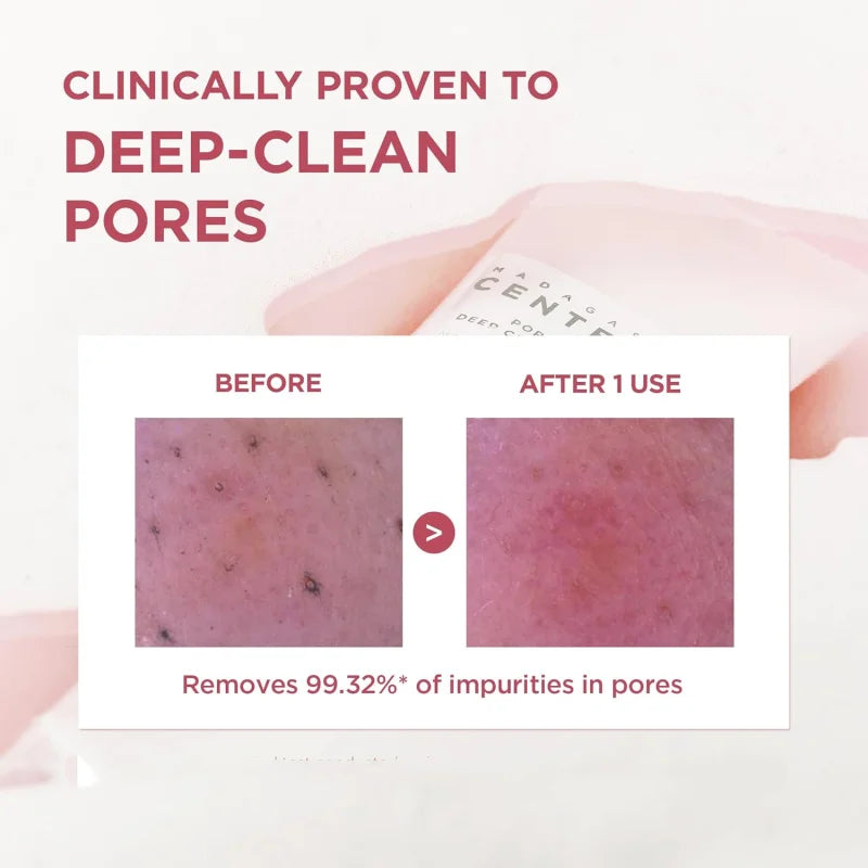 SKIN1004 Centella Madagascar Espuma Limpiadora Profunda Poremizing Pink Salt 125 ml