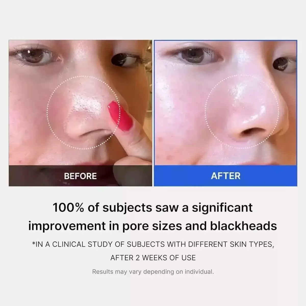 Pads Exfoliantes Medicube Zero Pore